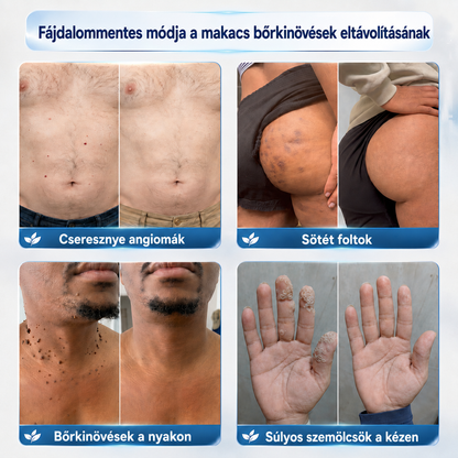 🎉✅𝐄𝐋𝐀𝐕𝐘𝐑𝐀® 𝟕 𝐧𝐚𝐩 𝐒𝐳𝐞𝐦ö𝐥𝐜𝐬- é𝐬 𝐟𝐨𝐥𝐭𝐞𝐥𝐭á𝐯𝐨𝐥í𝐭ó 𝐤𝐫é𝐦👩‍⚕️ (Zero Pain, Zero 𝐒𝐜𝐚𝐫𝐬 Formula)