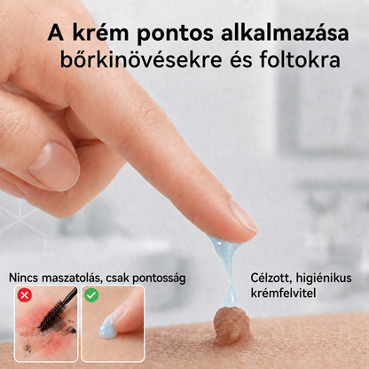 🎉✅𝐄𝐋𝐀𝐕𝐘𝐑𝐀® 𝟕 𝐧𝐚𝐩 𝐒𝐳𝐞𝐦ö𝐥𝐜𝐬- é𝐬 𝐟𝐨𝐥𝐭𝐞𝐥𝐭á𝐯𝐨𝐥í𝐭ó 𝐤𝐫é𝐦👩‍⚕️ (Zero Pain, Zero 𝐒𝐜𝐚𝐫𝐬 Formula)