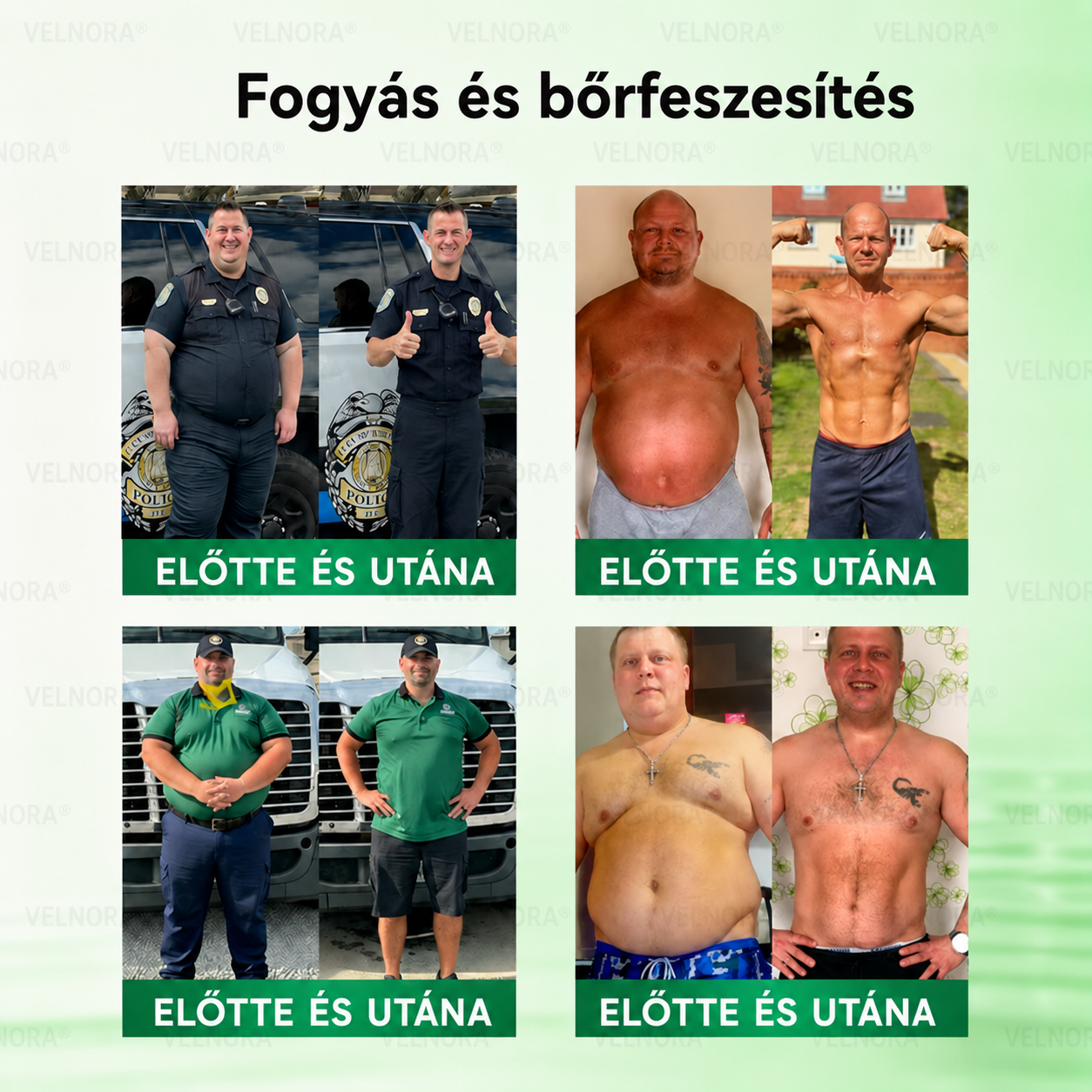 🎉🎁 Hivatalos áruház | 𝐕𝐄𝐋𝐍𝐎𝐑𝐀® Moringa & Berberin 10 az 1-ben fejlett nano-mikrotűs tapasz (naponta csak egyszer, már 7 nap alatt látható változások)