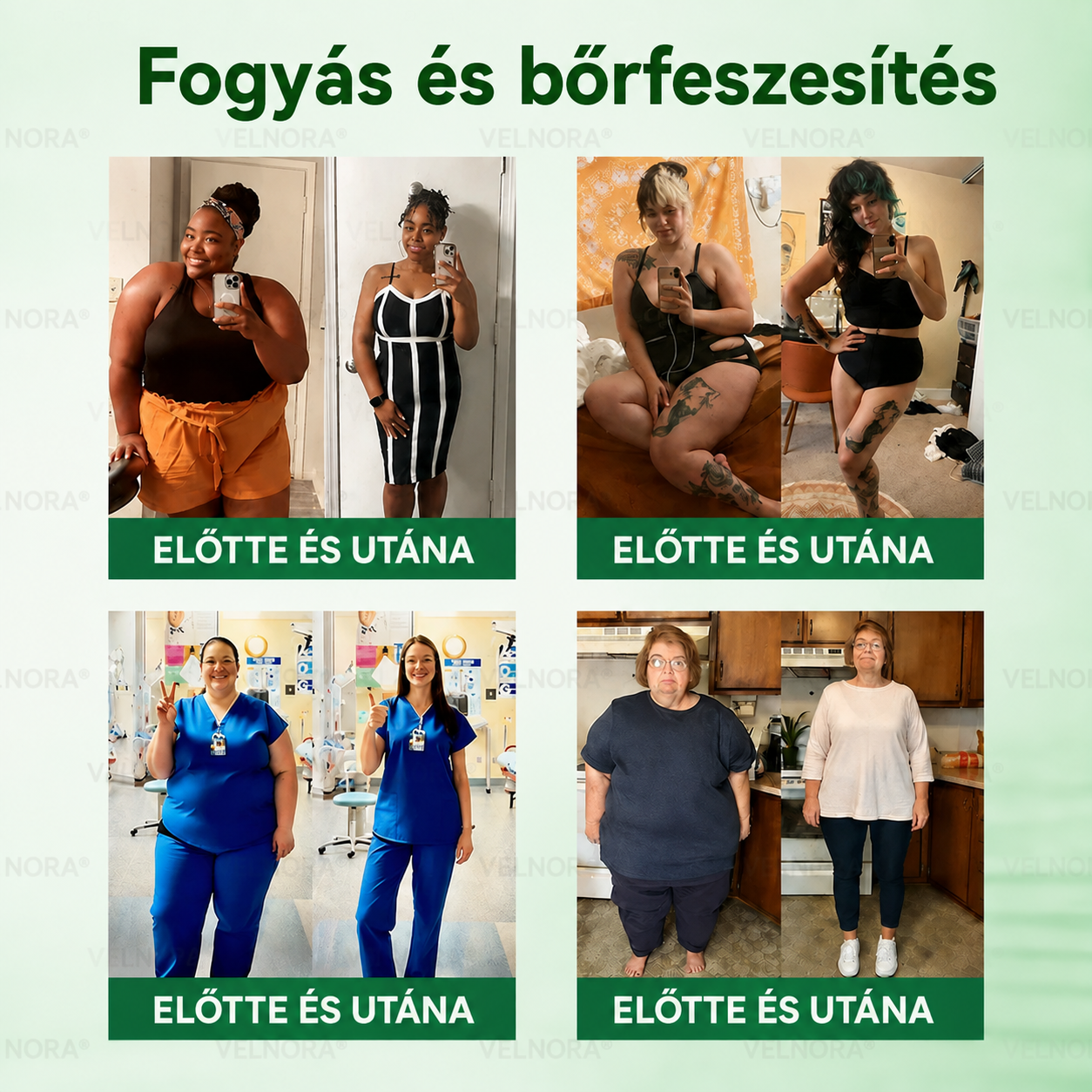 🎉🎁 Hivatalos áruház | 𝐕𝐄𝐋𝐍𝐎𝐑𝐀® Moringa & Berberin 10 az 1-ben fejlett nano-mikrotűs tapasz (naponta csak egyszer, már 7 nap alatt látható változások)