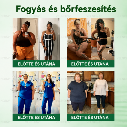 🎉🎁 Hivatalos áruház | 𝐕𝐄𝐋𝐍𝐎𝐑𝐀® Moringa & Berberin 10 az 1-ben fejlett nano-mikrotűs tapasz (naponta csak egyszer, már 7 nap alatt látható változások)