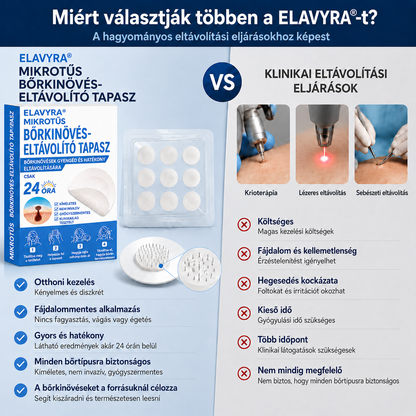🎉✅𝑯𝒊𝒗𝒂𝒕𝒂𝒍𝒐𝒔 á𝒓𝒖𝒉á𝒛 | 𝐄𝐋𝐀𝐕𝐘𝐑𝐀® 🌿 𝑴𝒊𝒌𝒓𝒐𝒕ű𝒔 𝑯𝒊𝒃á𝒕𝒍𝒂𝒏 𝑩ő𝒓 𝑩ő𝒓𝒌𝒊𝒏ö𝒗é𝒔-𝑬𝒍𝒕á𝒗𝒐𝒍í𝒕ó 𝑻𝒂𝒑𝒂𝒔𝒛 (𝑩ő𝒓𝒌𝒊𝒏ö𝒗é𝒔𝒆𝒌, 𝒂𝒑𝒓ó 𝒃ő𝒓𝒌𝒊𝒏ö𝒗é𝒔𝒆𝒌, 𝒔𝒛𝒆𝒎ö𝒍𝒄𝒔ö𝒌, 𝒂𝒏𝒚𝒂𝒋𝒆𝒈𝒚𝒆𝒌, ö𝒓𝒆𝒈𝒔é𝒈𝒊 𝒇𝒐𝒍𝒕𝒐𝒌 é𝒔 𝒑𝒊𝒈𝒎𝒆𝒏𝒕á𝒄𝒊ó𝒔 𝒑𝒓𝒐𝒃𝒍é𝒎á𝒌 𝒆𝒔𝒆𝒕é𝒏)